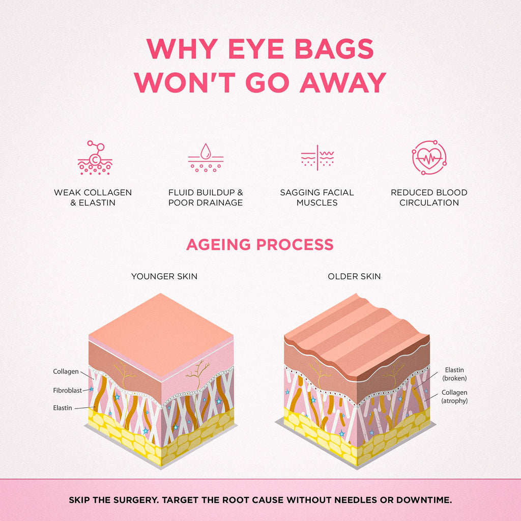 RevitalEyes® 2-in-1 Red Light Therapy + EMS To Erase Eye Bags
